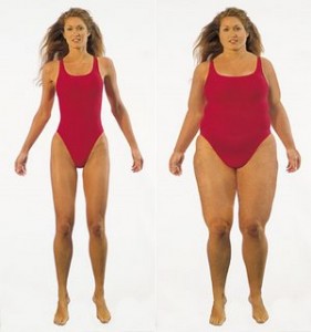 weight-loss-before-after-281x300.jpg
